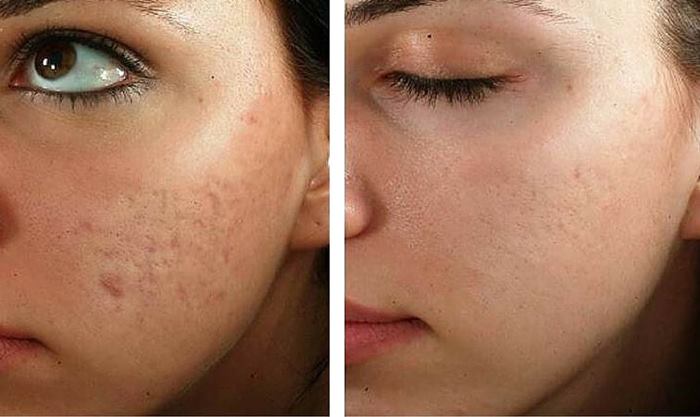 پوست کرم ترمیم کننده صورت؛ راهی برای رفع آسیب های پوستی