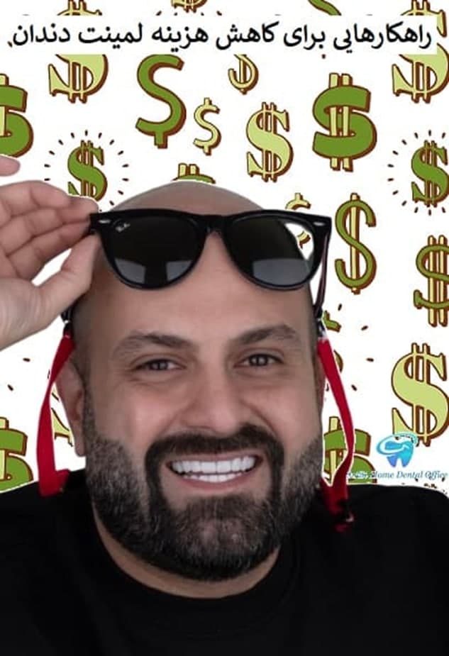 لمینت دندان